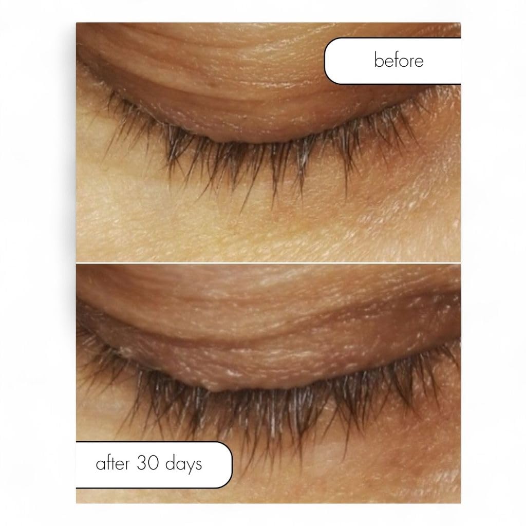 Serious Skincare Lash Bath with waterproof mascara removal on eye surface.