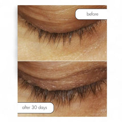 Serious Skincare Lash Bath with waterproof mascara removal on eye surface.