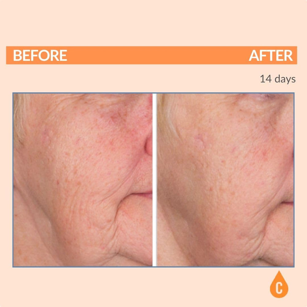 Serious Skincare no white cast finish close-up across skin tone