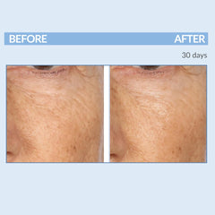 Serious Skincare Retinol Cream swatch on skin showing soothing hydration.