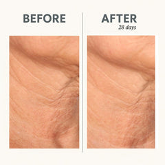 Serious Skincare Reverse Lift crepey texture closeup highlighting skin refinements