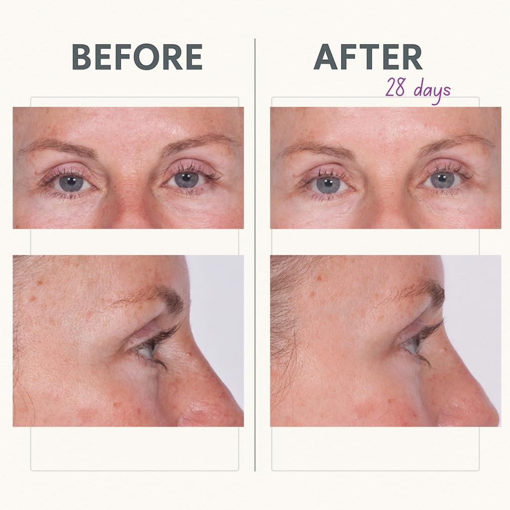 Reverse Lift Eye Cream firming around eyes and upper lid.