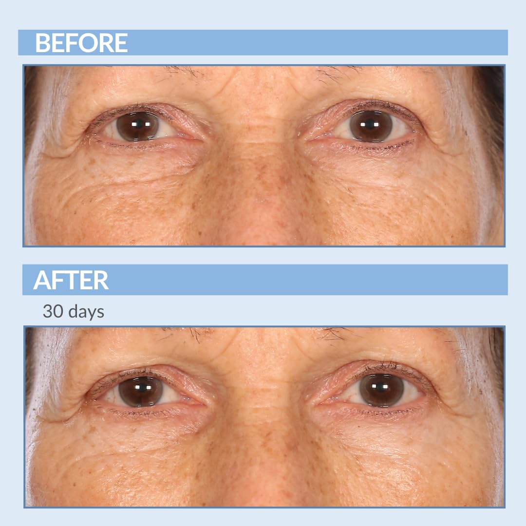 Serious Skincare Vitamin A Force XR encapsulation close-up shows gentle release.