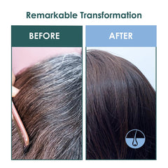 SH-RD safe for color-treated hair supports gentle nourishment.