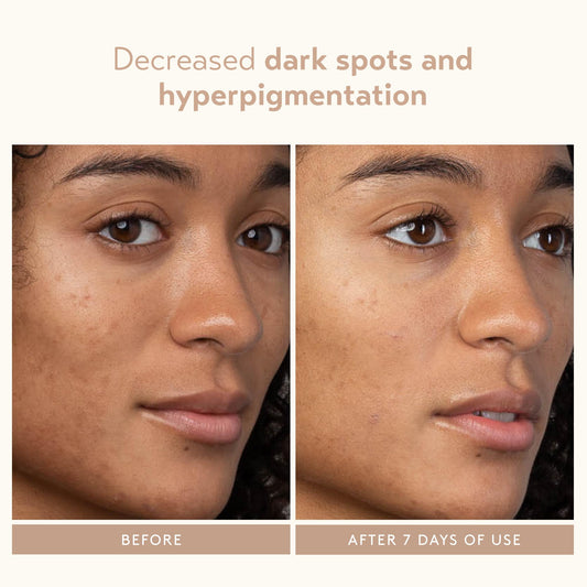 SHANI DARDEN Lactic Acid Face Serum pump close-up shows smooth application.