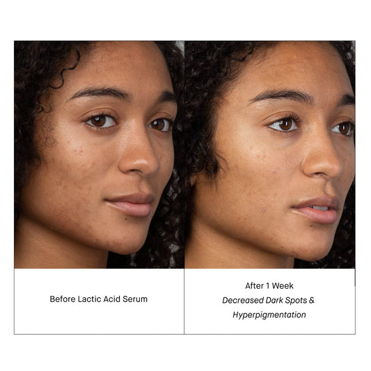 Closeup of Shani Darden Lactic Acid Serum pump for even application.