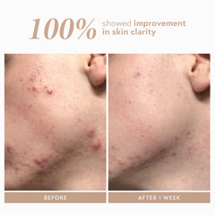 Shani Darden Rescue Serum ingredients hyaluronic acid supports hydration