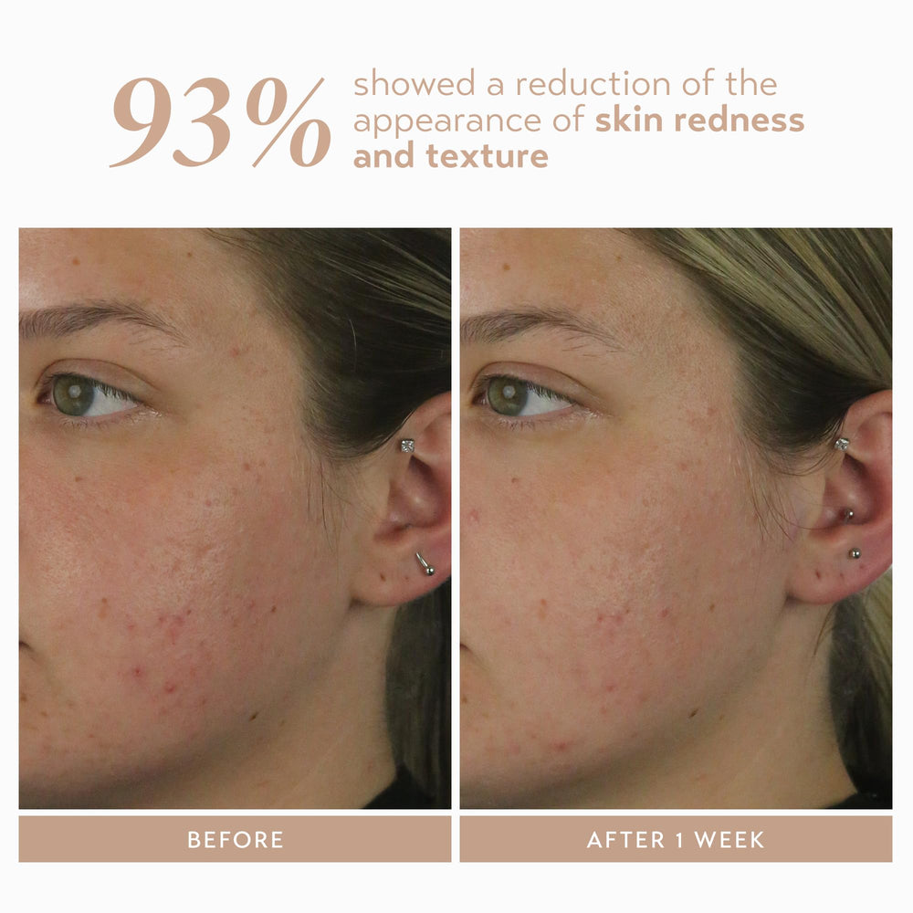 Shani Darden Rescue Serum with licorice and aloe for balance