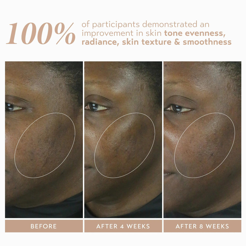 Applying SHANI DARDEN Retinol Reform to face and neck before bed
