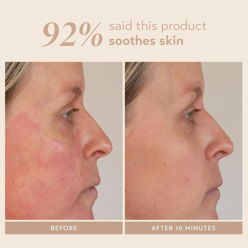 SHANI DARDEN Signature Nourishing Facial Mask triple-tea complex benefits close-up