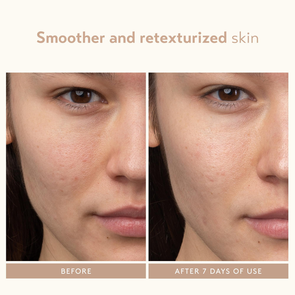 Travel-size packaging of SHANI DARDEN serum for on-the-go skincare routines.