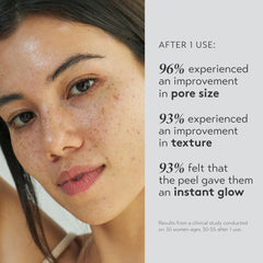 Shani Darden Triple Acid Peel Step 1 application image showing gentle exfoliation.
