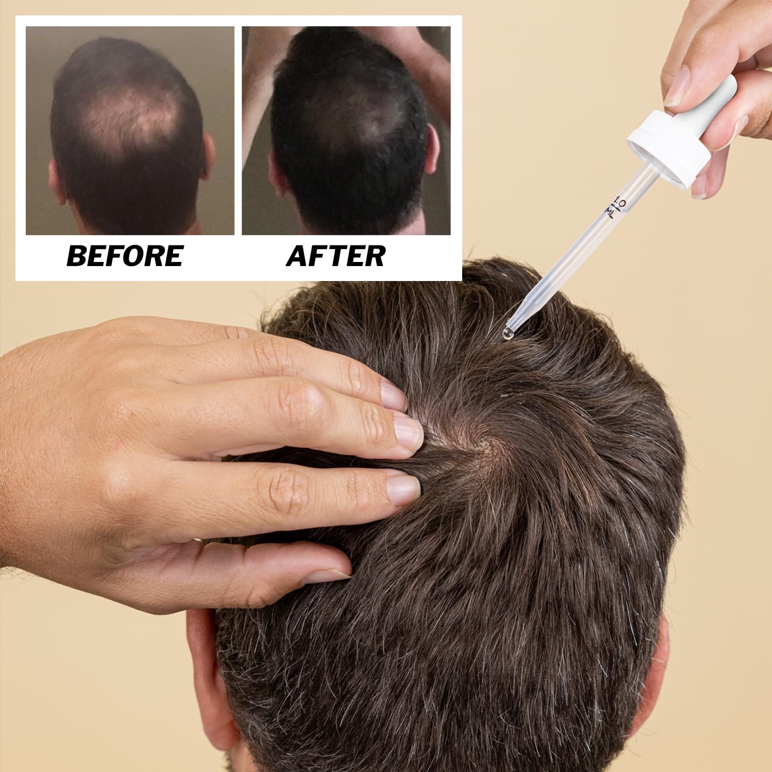 Shapiro MD Complete Anti Hair Loss Solution kit on display