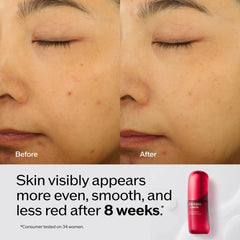 Shiseido Ultimune refill packaging emphasizing sustainable refill option for skincare routine