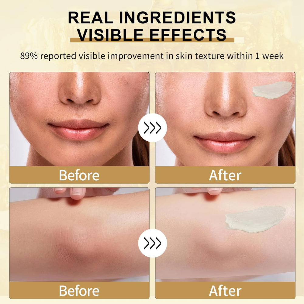 Hands applying SIBITBIT balm to moisturize dry skin.