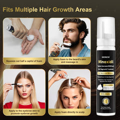 Sidinox Minoxidil Foam massaged into the scalp supports integration.
