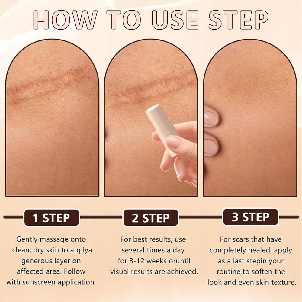 Silicone Scar Stick after-surgery use for targeted scar management.