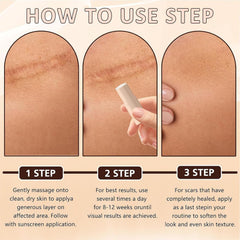 Silicone Scar Stick after-surgery use for targeted scar management.