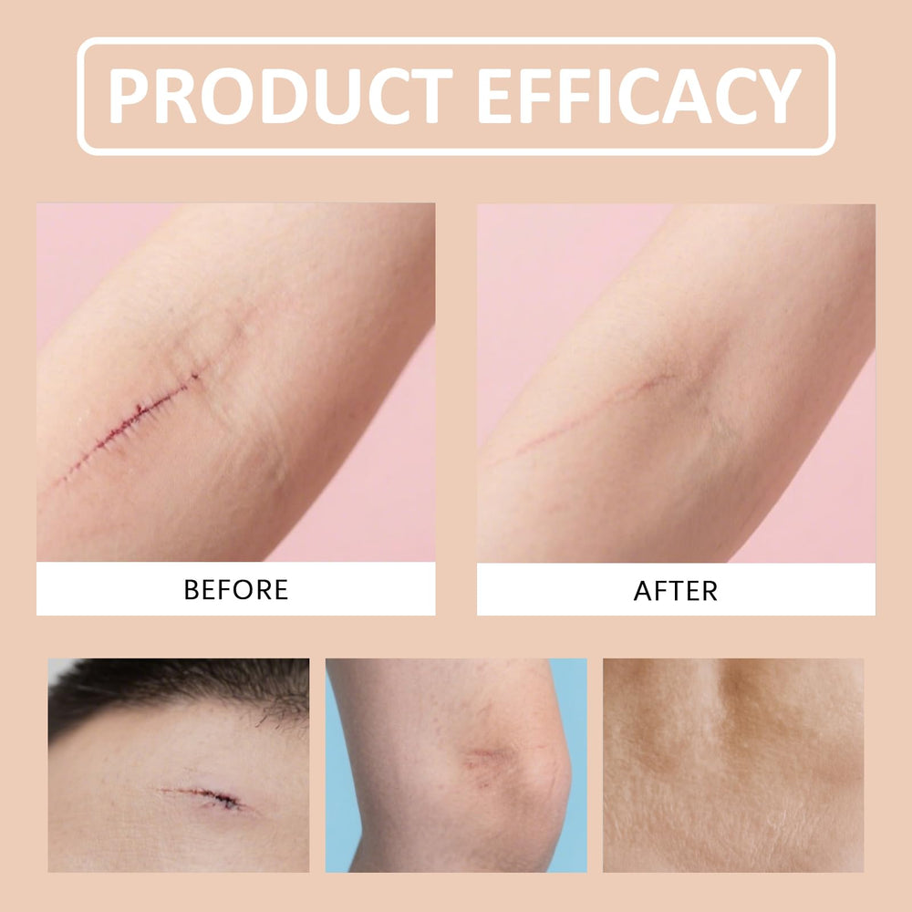 Silicone Scar Stick easy application technique for clean routine.