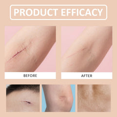 Silicone Scar Stick easy application technique for clean routine.