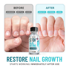 SISQUOC Stop Nail Biting nails with clear coat; easy daily wear.