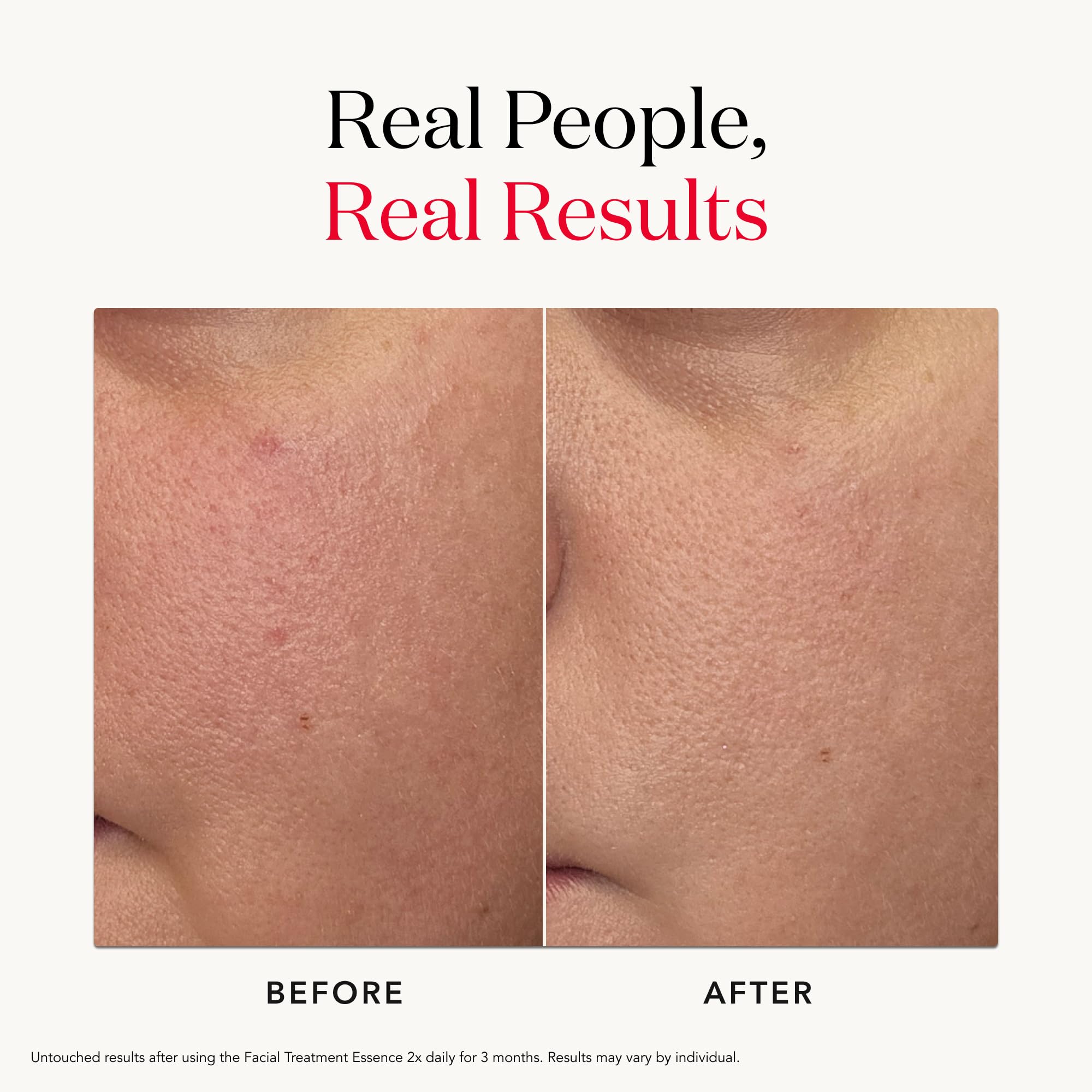 Hands applying SK-II Facial Treatment Essence after cleansing for quick absorption.