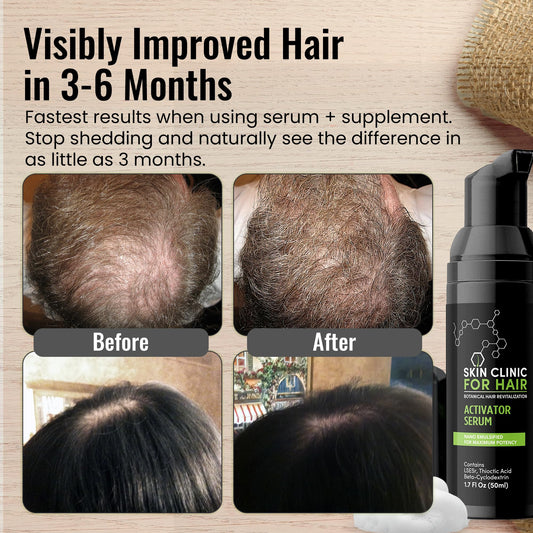 Skin Clinic for Hair foaming serum applied to the scalp for nourishment.