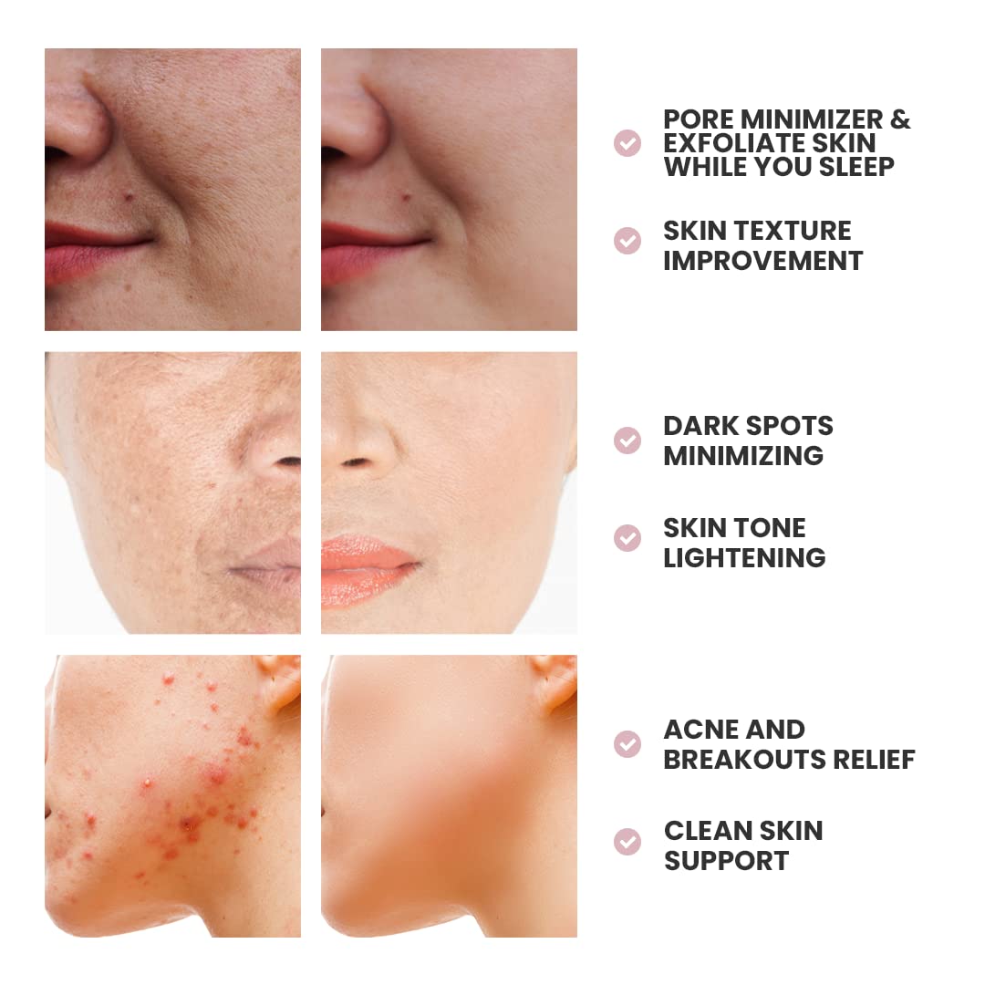 Skin Deva Glycolic Cream bottle close-up highlights premium feel.