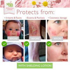 Skin MD Shielding ingredients list highlights natural botanicals for nourishment.