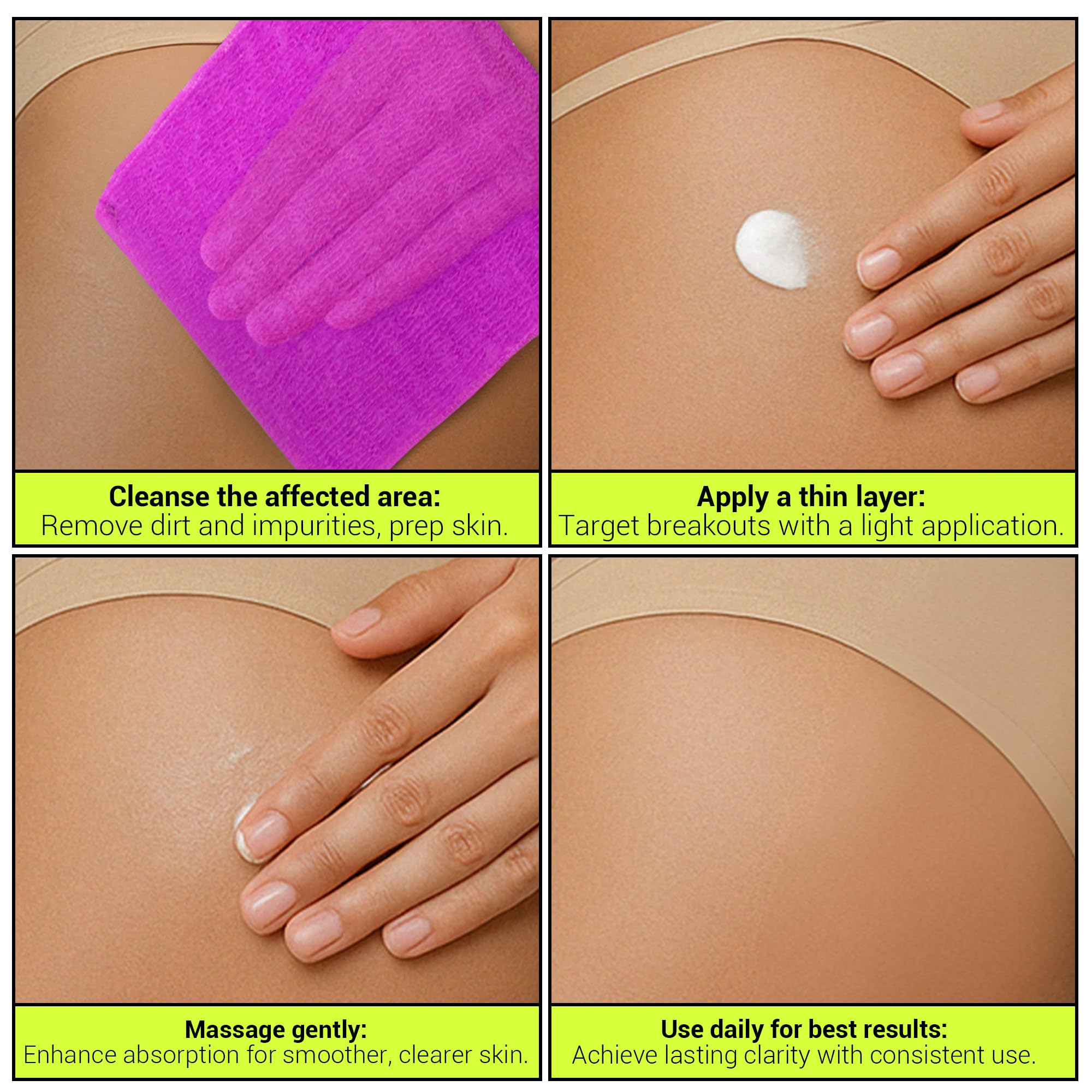 SKINBOSS applying lotion on back and bum area for daily care.