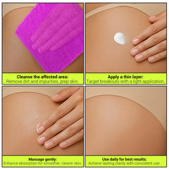 SKINBOSS applying lotion on back and bum area for daily care.