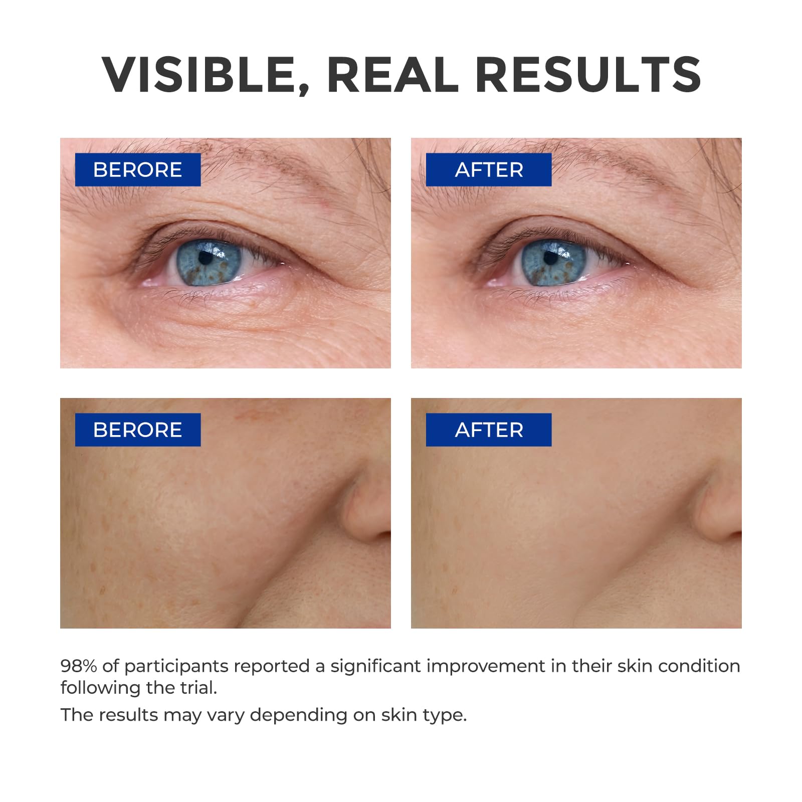 SKINERSE serum-absorbs-fast texture highlights lightweight, non-greasy finish.