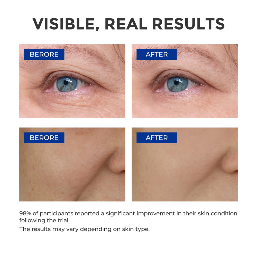 SKINERSE serum-absorbs-fast texture highlights lightweight, non-greasy finish.