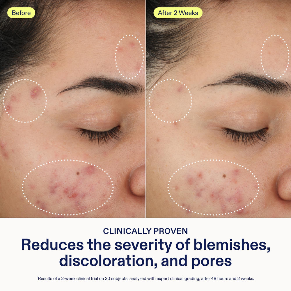Close-up of Skinfix foam showing gentle exfoliation for smoother texture.