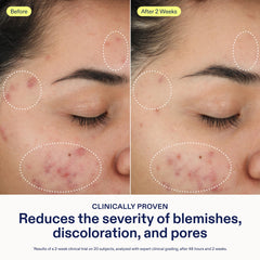Close-up of Skinfix foam showing gentle exfoliation for smoother texture.