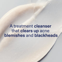 Skinfix 2% BHA Cleanser foaming lather helps clear pores.