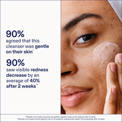 Skinfix formula with green tea soothes inflammation and helps balance skin.