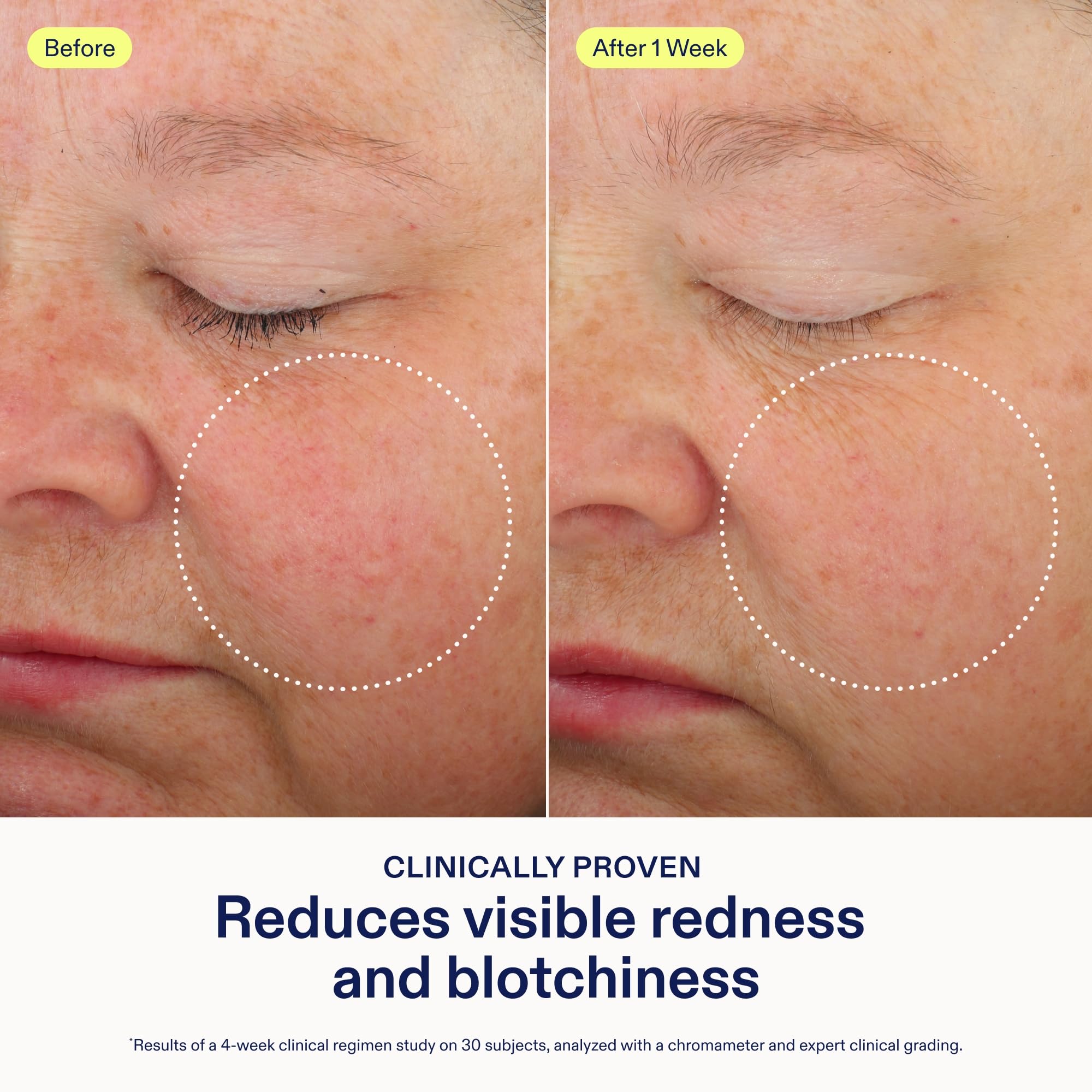 Skinfix overnight mask applied to cheek indicating reduced redness and refreshed appearance.