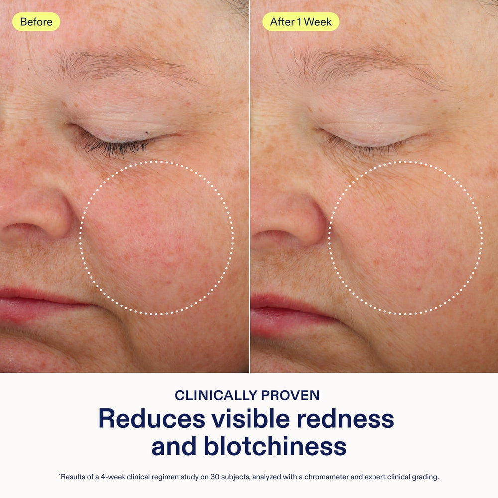 Skinfix overnight mask applied to cheek indicating reduced redness and refreshed appearance.