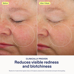Skinfix overnight mask applied to cheek indicating reduced redness and refreshed appearance.