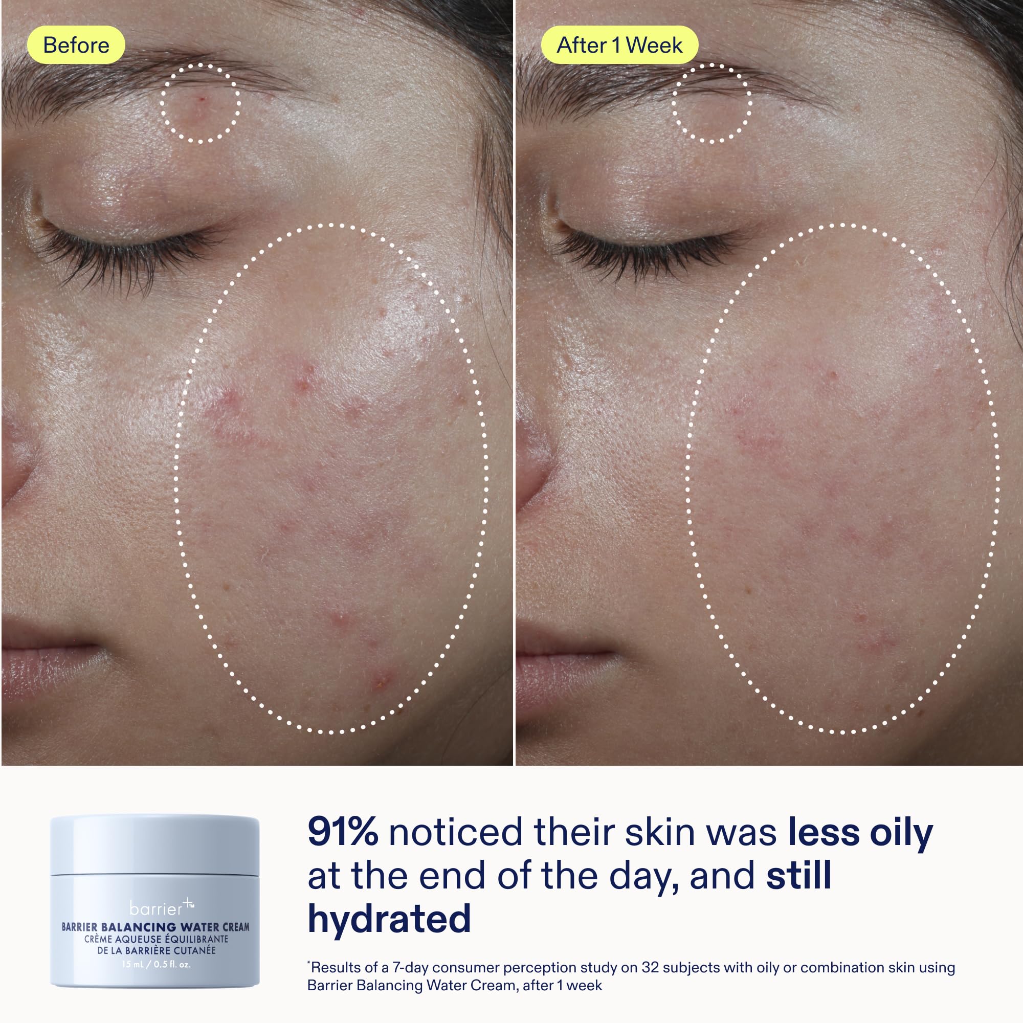 Skinfix Balancing Complex graphic illustrates oil control and radiance boost