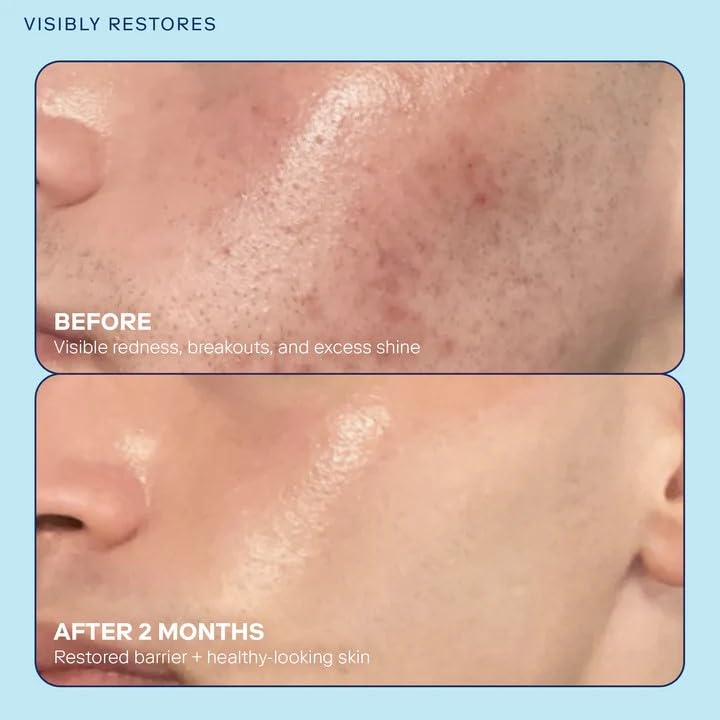 Skinfix Barrier+ Gel Cream Mini texture application on dry skin.