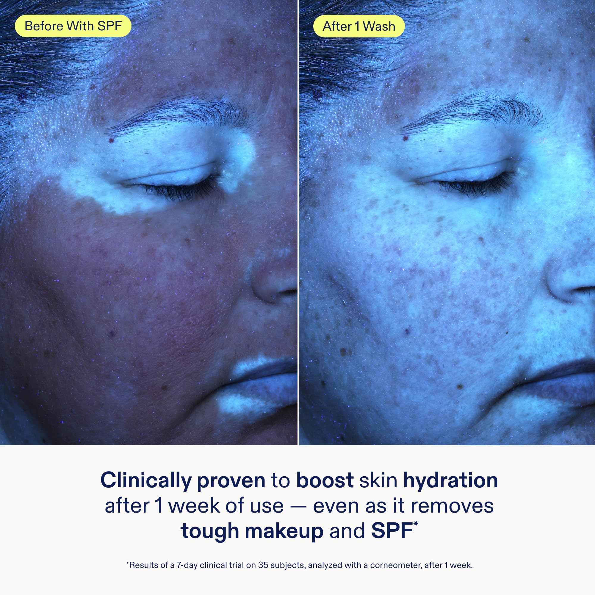 Skinfix cleanser dissolves SPF residue from skin after sun exposure