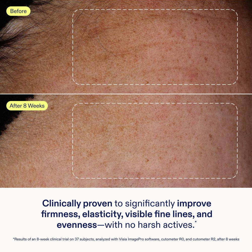 Skinfix Exo Ectoin Intensive Repair Baume fragrance-free packaging emphasizes clean formula.
