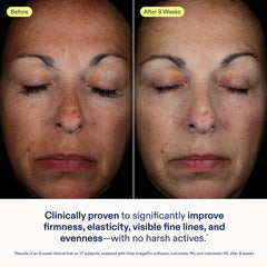 Skinfix Exo Ectoin Intensive Repair Baume silky texture shown for quick absorption on skin.