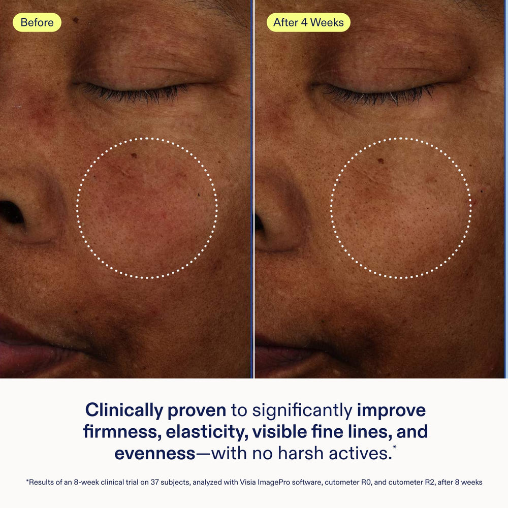 Skinfix Exo Ectoin Intensive Repair Baume vegan cruelty-free identity in product presentation.