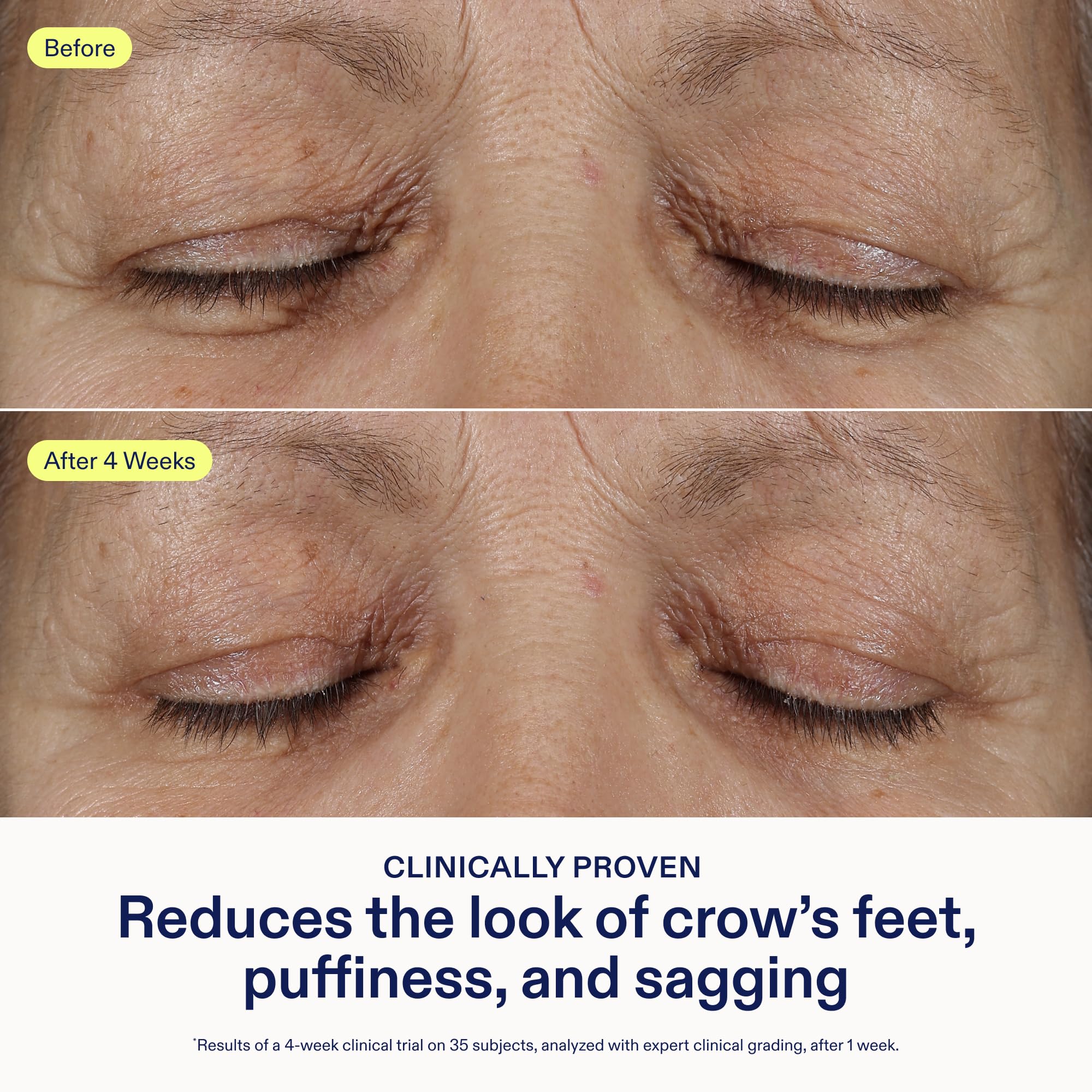 Skinfix eye cream acts as a makeup primer for a smoother base.