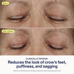 Skinfix eye cream acts as a makeup primer for a smoother base.
