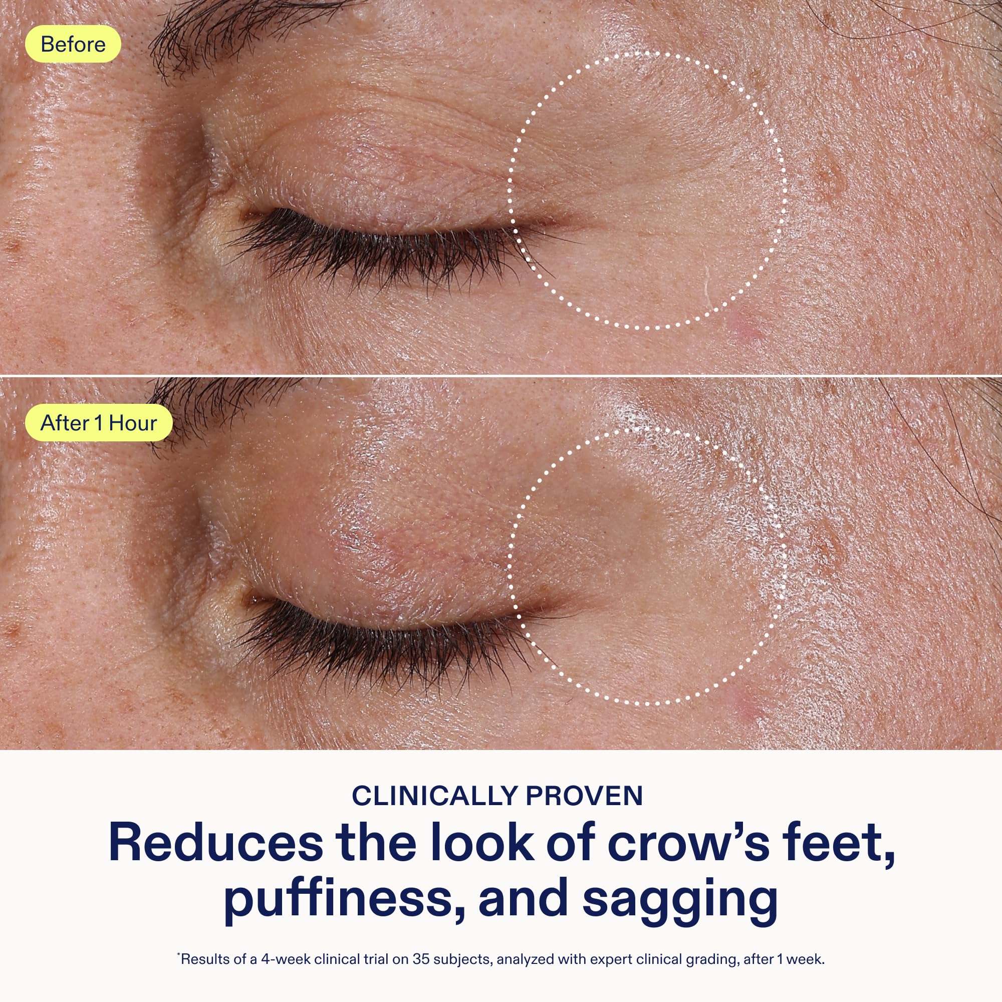 Skinfix Eye Treatment under-eye cream reduces puffiness when applied gently.