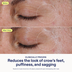 Skinfix Eye Treatment under-eye cream reduces puffiness when applied gently.